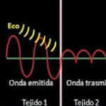 Física de Ultrasonidos ($ARS)